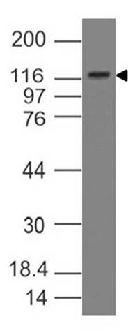 Monoclonal Antibody to DNMT3b (Clone:ABM1C25 )