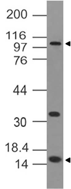 Monoclonal Antibody to DNMT3a (Clone: ABM13G4 )