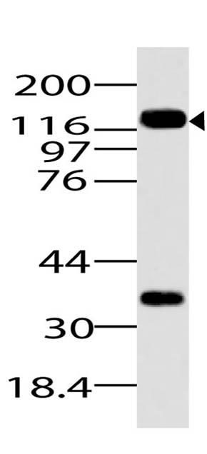 Monoclonal Antibody to DNMT3a (Clone: ABM1F35)