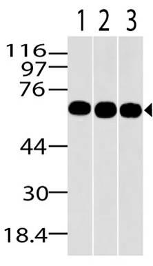 Monoclonal Antibody to MBD1 (Clone: ABM15H2)