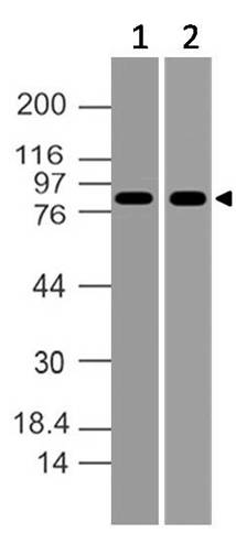 Monoclonal Antibody to MLH1 (Clone:ABM17C1)