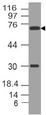 Monoclonal antibody to FOXM1 (Clone: ABM5F61)