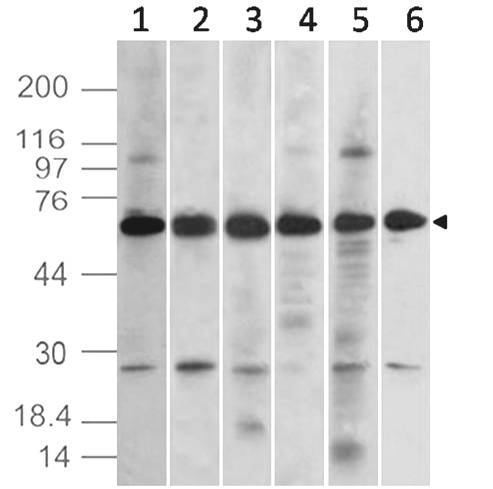 Monoclonal antibody to TEM7 (Clone: ABM1D82)