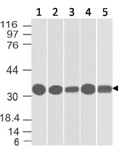 Monoclonal Antibody to EpCAM (CD326) Cytoplasmic Domain (Clone: ABM2C92)