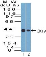 Monoclonal Antibody to CK19 (Clone: A53-B/A2)