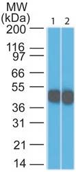 Monoclonal Antibody to CK18 (Clone: DC10)