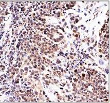 Monoclonal Antibody to p21 (Clone: WA-1)