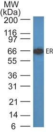 Monoclonal Antibody to Estrogen Receptor (Clone: C-70)(Discontinued)