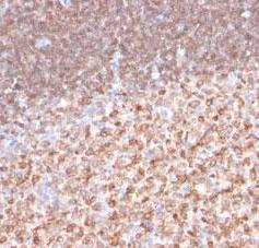 Monoclonal Antibody to CD74w (Clone: LN-2) Monoclonal Antibody to CD74w (Clone: LN-2)