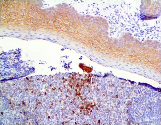 Monoclonal Antibody to Desmoglein 3 (Clone: ABM4A31)