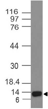 Monoclonal Antibody to ALK-1 (Clone: ABM43C4)