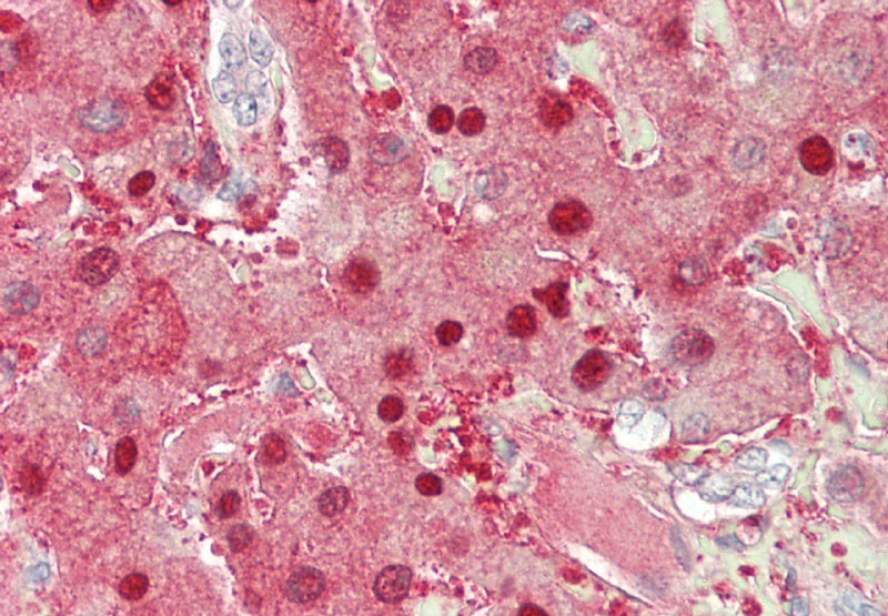 Monoclonal Antibody to Arginase-1 (Clone: ABM4B35)