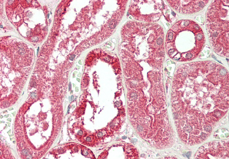 Monoclonal Antibody to E-cadherin (Clone: ABM43F8)