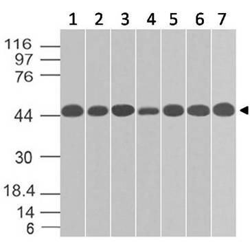 Monoclonal Antibody to TOX-3 (Clone: ABM44A1)