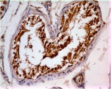 Monoclonal Antibody to IDH1 (Clone: ABM44B3)