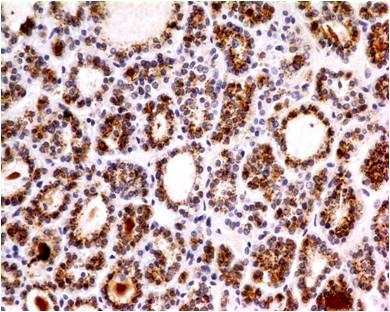 Monoclonal Antibody to Parathyroid Hormone (Clone: ABM4D44)