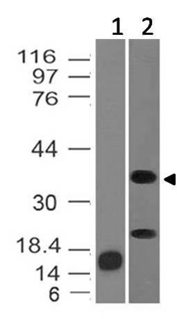 Monoclonal Antibody to Inhibin alpha (Clone: ABM44F5)