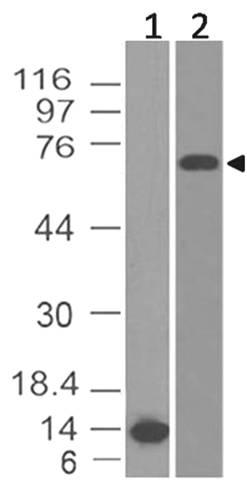 Monoclonal Antibody to BCL-6 (Clone: ABM44G9)