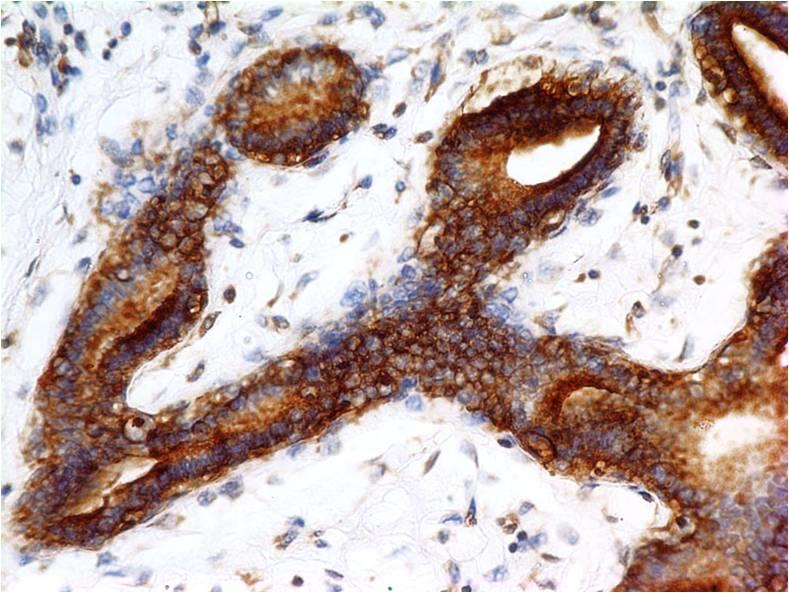 Monoclonal Antibody to c-erbB-2/Her2 (Clone: ABM45F5)