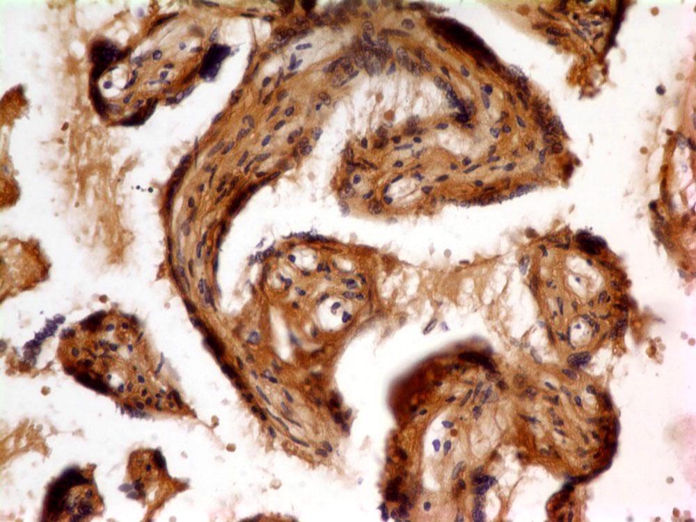 Monoclonal Antibody to FLT1 (Clone: ABM4A56)