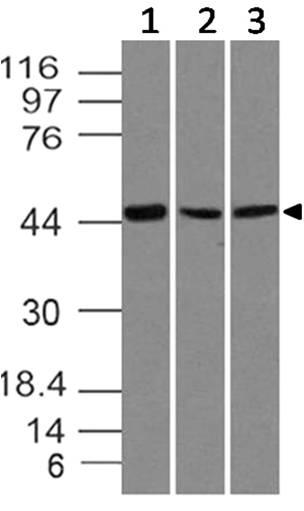 Monoclonal Antibody to SOX11 (Clone: ABM45D9)