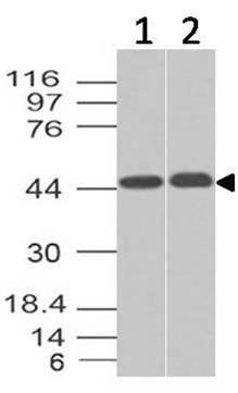 Monoclonal Antibody to Napsin A (Clone: ABM4H60)