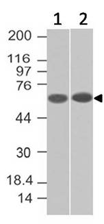 Monoclonal Antibody to Endoglin (Clone: ABM46D3)