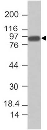 Monoclonal Antibody to Villin (Clone: ABM4E64)