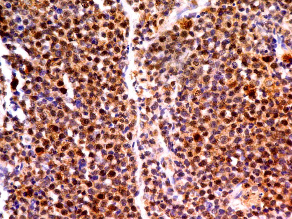 Monoclonal Antibody to MLH1 (Clone: ABM4D74)