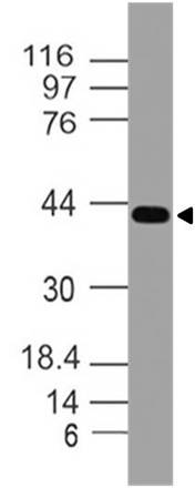 Monoclonal antibody to FOXA1 (Clone: ABM4A82)