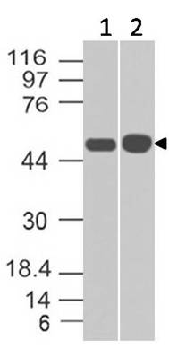 Monoclonal antibody to Alpha 1 Antitrypsin (Clone: ABM48F6)