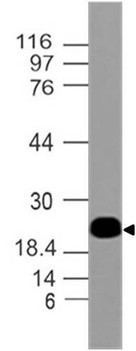 Monoclonal antibody to Troponin 1 (Clone: ABM49D9)