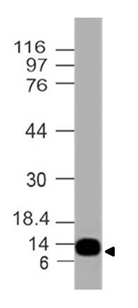 Monoclonal antibody to S100A4 (Clone: ABM48F7)