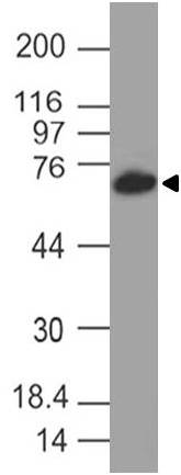 Monoclonal antibody to SLC34A1 (Clone: ABM5G13 )