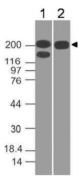 Monoclonal Antibody to Spectrin beta 3 (Clone: ABM5A16)