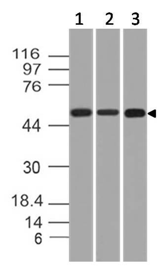 Monoclonal antibody to KRT76 (Clone: ABM51A8)