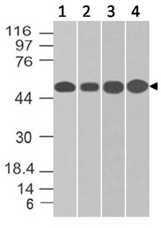 Monoclonal antibody to NSE Gamma (Clone: ABM5D20)