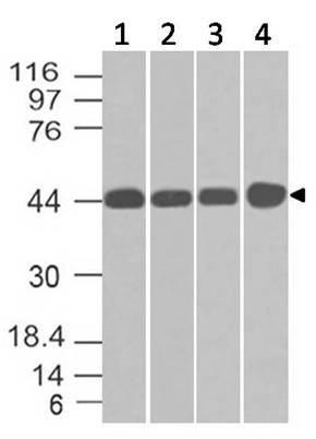 Monoclonal antibody to NDRG1 (Clone: ABM51C9 )