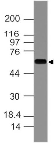 Monoclonal antibody to KRT77 (Clone: ABM5G22)