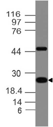 Monoclonal antibody to Adiponectin (Clone: ABM52A3 )