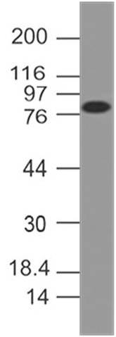 Monoclonal Antibody to FSH Receptor (Clone: ABM5D29)