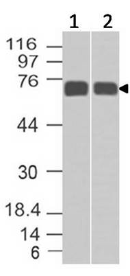 Monoclonal Antibody to MMP2 (Clone: ABM5A31)