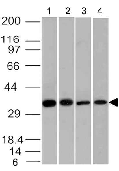 Rabbit Monoclonal Antibody to EpCAM (Clone: ABM53D8)