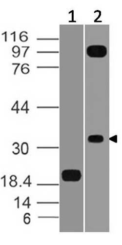 Monoclonal Antibody to VISTA (Clone: ABM1A1.1E7)