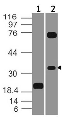 Monoclonal Antibody to VISTA (Clone: ABM1F9.1F6)