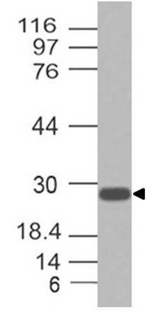 Monoclonal antibody to Troponin 1 (Clone: ABM5A65)