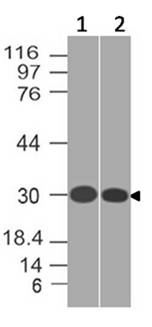 Monoclonal antibody to SLC31A1 (Clone: ABM5D89)