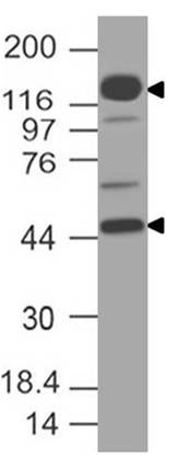 Monoclonal antibody to NUT (Clone: ABM56F7)