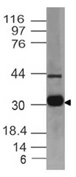 Monoclonal antibody to MHC classII (Clone: ABM56C9)