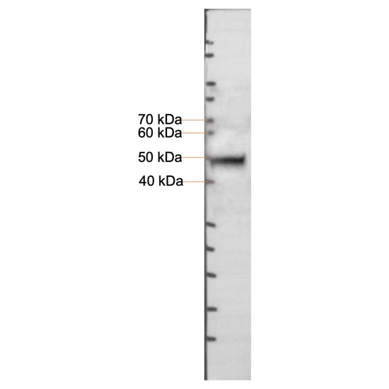 Monoclonal antibody to WT1 (Clone: 6F-H17)